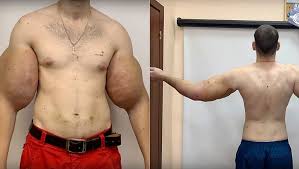 Image result for SYNTHOL