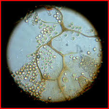 Attēlu rezultāti vaicājumam “Cribraria ferruginea spores”