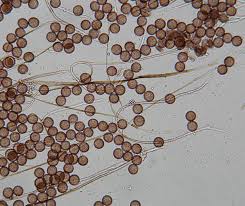 Attēlu rezultāti vaicājumam “Diderma globosum sessile”