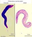 <b>Enterobius</b> vermicularis