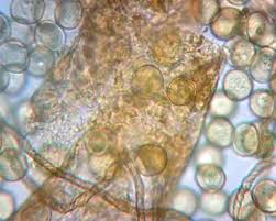 Attēlu rezultāti vaicājumam “Trichia contorta spores”