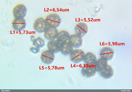 Attēlu rezultāti vaicājumam “Comatricha meandrispora”