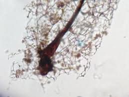 Attēlu rezultāti vaicājumam “Stemonitis flavogenita”