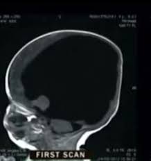 Image result for no brain