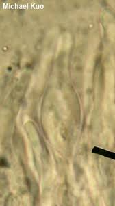 Attēlu rezultāti vaicājumam “Trichia alpina spores”