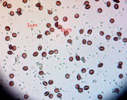 Attēlu rezultāti vaicājumam “Fuligo luteonitens”