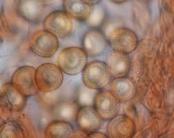 Attēlu rezultāti vaicājumam “Metatrichia floriformis stalked”