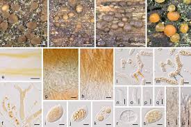 Attēlu rezultāti vaicājumam “Dacrymyces chrysospermus spores”