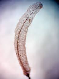 Attēlu rezultāti vaicājumam “Stemonitopsis aequalis var. microspora spores”