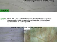 Attēlu rezultāti vaicājumam “Vibrissea decolorans”