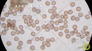 Attēlu rezultāti vaicājumam “Physarum psittacinum spores”