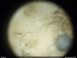 Attēlu rezultāti vaicājumam “Lycogala sphaeroconicum macro”