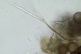 Attēlu rezultāti vaicājumam “Didymium nigripes young”