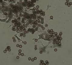 Attēlu rezultāti vaicājumam “Physarum album spores”