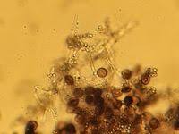 Attēlu rezultāti vaicājumam “Diderma effusum spores”