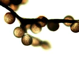 Attēlu rezultāti vaicājumam “Amaurochaete atra macro”