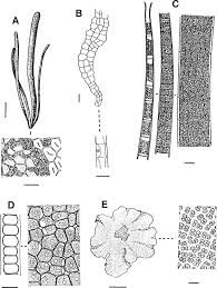Attēlu rezultāti vaicājumam “Trentepohlia sp.”