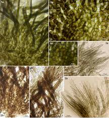 Attēlu rezultāti vaicājumam “Hyphodiscus hymeniophilus”