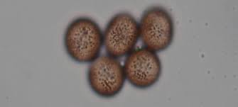 Attēlu rezultāti vaicājumam “Physarum luteolum”