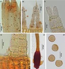 Attēlu rezultāti vaicājumam “Ulota crispa sporophyte”