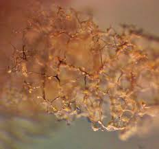 Attēlu rezultāti vaicājumam “Lycogala ustulatum sessile”