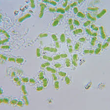 Attēlu rezultāti vaicājumam “Chaenotheca stemonea”