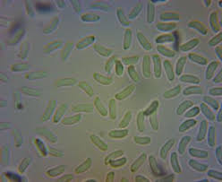 Attēlu rezultāti vaicājumam “Basidioradulum radula”