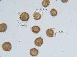 Attēlu rezultāti vaicājumam “Acaulon muticum sporophyte”