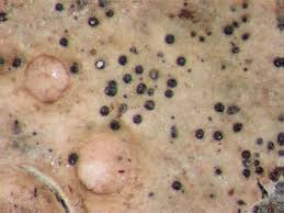 Attēlu rezultāti vaicājumam “Opegrapha rufescens”