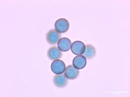 Attēlu rezultāti vaicājumam “Stemonaria irregularis stalked”