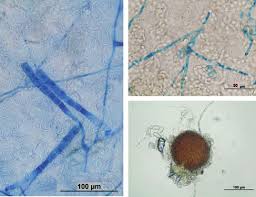 Attēlu rezultāti vaicājumam “Erysiphe galeopsidis”