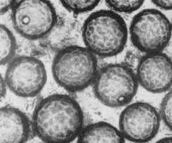 Attēlu rezultāti vaicājumam “Orbilia sp.”