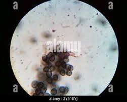 Attēlu rezultāti vaicājumam “Physarum psittacinum spores”