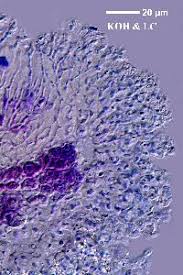 Attēlu rezultāti vaicājumam “Lecanora albella”