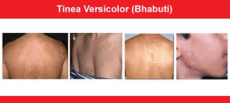 Attēlu rezultāti vaicājumam “Badhamia versicolor”