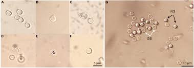Attēlu rezultāti vaicājumam “Badhamia juliae spores”
