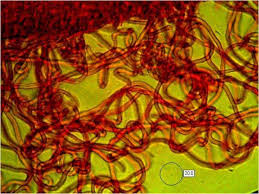 Attēlu rezultāti vaicājumam “Sarcoscypha austriaca”