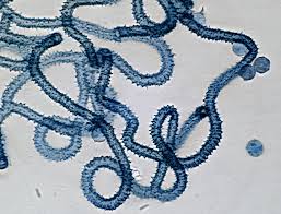 Attēlu rezultāti vaicājumam “Heterotrichia obvelata (syn. Arcyria obvelata) young”