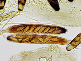 Attēlu rezultāti vaicājumam “Ascobolus furfuraceus”