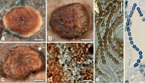 Attēlu rezultāti vaicājumam “Trichia ambigua spores”