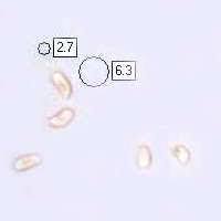 Attēlu rezultāti vaicājumam “Trametes gibbosa”