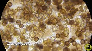 Attēlu rezultāti vaicājumam “Didymium melanospermum spores”