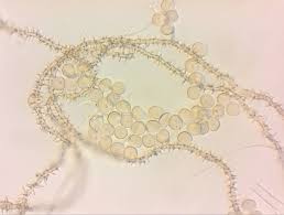 Attēlu rezultāti vaicājumam “Ophiotheca chrysosperma”