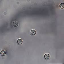 Attēlu rezultāti vaicājumam “Hemitrichia calyculata spores”