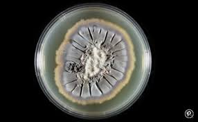 Attēlu rezultāti vaicājumam “Didymium spongiosum var. dictyospora spores”