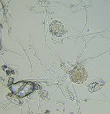 Attēlu rezultāti vaicājumam “Erysiphe galeopsidis”