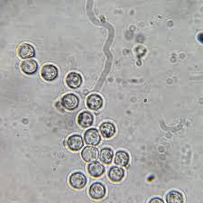 Attēlu rezultāti vaicājumam “Arcyria affinis spores”
