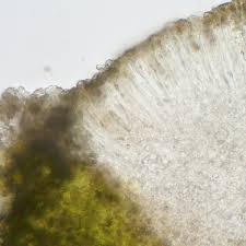 Attēlu rezultāti vaicājumam “Cliostomum corrugatum”