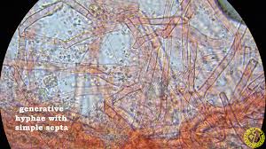 Attēlu rezultāti vaicājumam “Ceriporia excelsa”