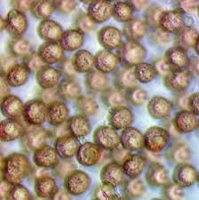 Attēlu rezultāti vaicājumam “Amaurochaete fusiformis macro”